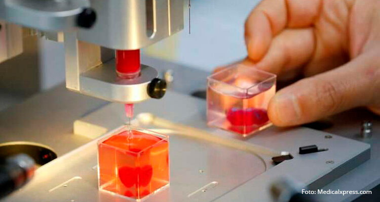 Stat efterspørgsel Et bestemt Forskere 3D printer verdens første hjerte med patientens egne celler -  Organdonation - ja tak!
